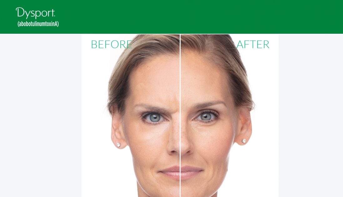 Dysport Cost Reduce Wrinkles Medical Spa Dallas, Plano, Austin, Texas