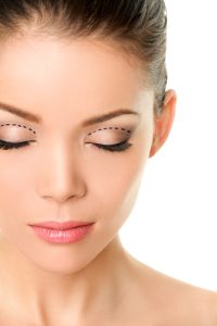 Guide to Upper Eyelid Surgery | Dallas Oculoplastic Surgeon | Plano